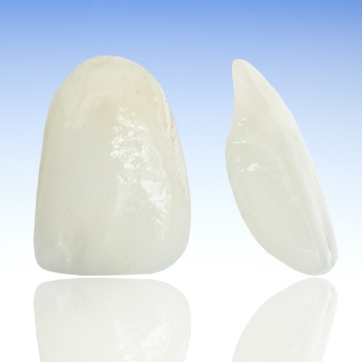 Samples of metal free dental restorations