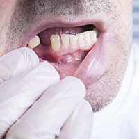 Man with a missing lower tooth