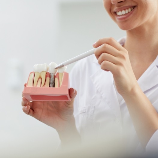 Dentist pointing to dental implant model