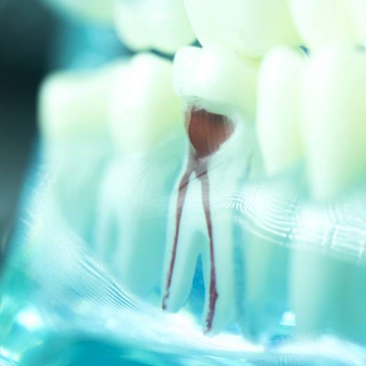 Model of a tooth’s root canals