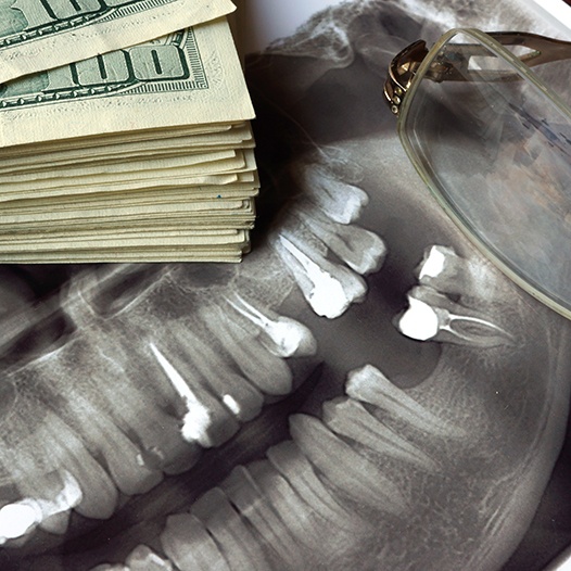 Patient in Pensacola looking at X-rays for root canals and stack of money