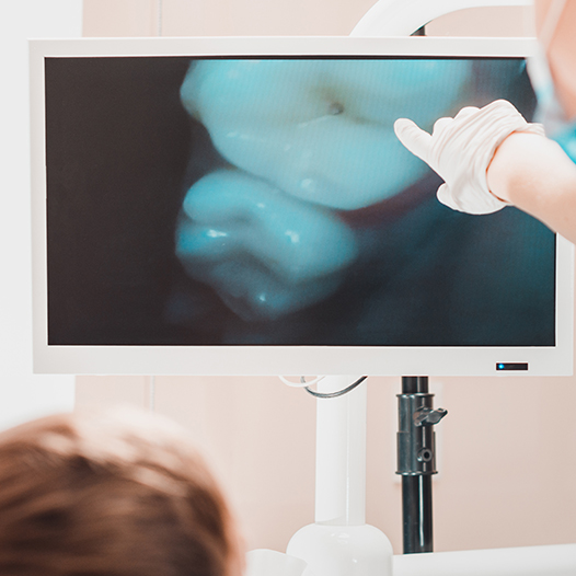 Man smiling before intraoral photographs are captured