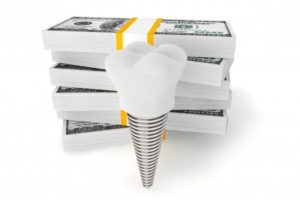 a dental implant in front of some money
