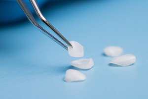 Picking up veneers with pair of tweezers