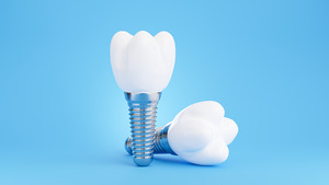 Two dental implants with white crowns